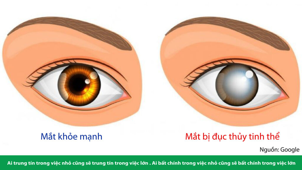 mat-bi-duc-thuy-tinh-the