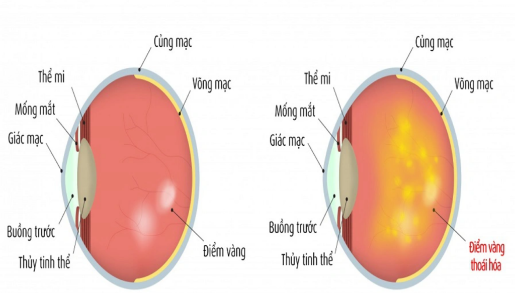 thoai-hoa-diem-vang